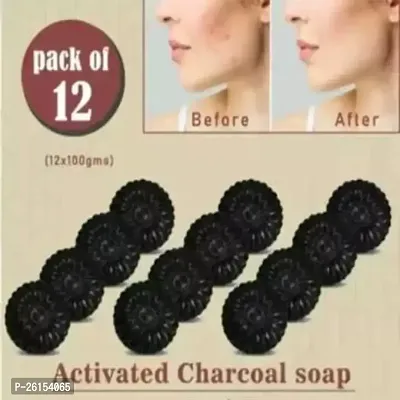 Activated Charcoal Soap For Women Skin Whitening, Acne, Blackheads, Anti Wrinkle, Pimple Skin Care Soap (Pack Of 12)-thumb0