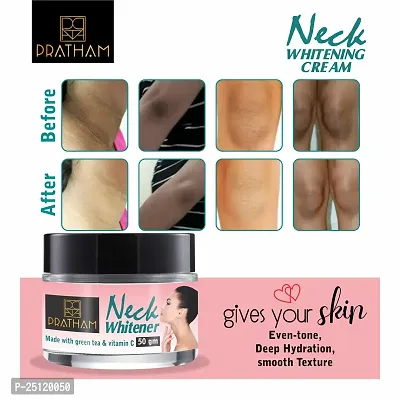 Pratham Underarm Neck Back Elbow Body Whitening Cream For Remove Dark Black Spots  Warts For Men  Women -(50 gm) Pack 1-thumb0