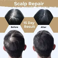 Ayurvedic  Bhringraj Promotes Hair Growth , Hair Fall ,Hair Oil-thumb1