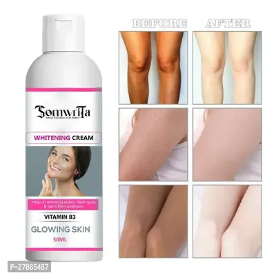 SOMWRITA Whitening Cream For Advanced Whitening  Brightening, Lightening Cream, Remove dark spot,remove acne,natural whitening PACK OF 1(50gm)