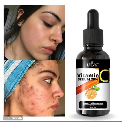 Professional vitamin c serum- face serum for women-thumb0