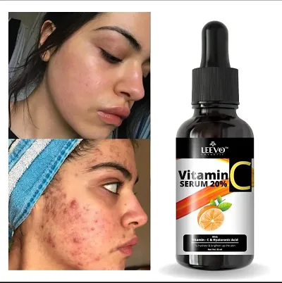 Clean And Clear Face Skin Serum