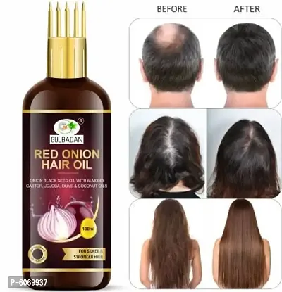 GULBADAN Onion Black Seed Hair Oil - WITH COMB APPLICATOR - Controls Hair Fall - NO Mineral Oil, Silicones, Cooking Oil and Synthetic Fragrance Hair Oil  (100 ml)