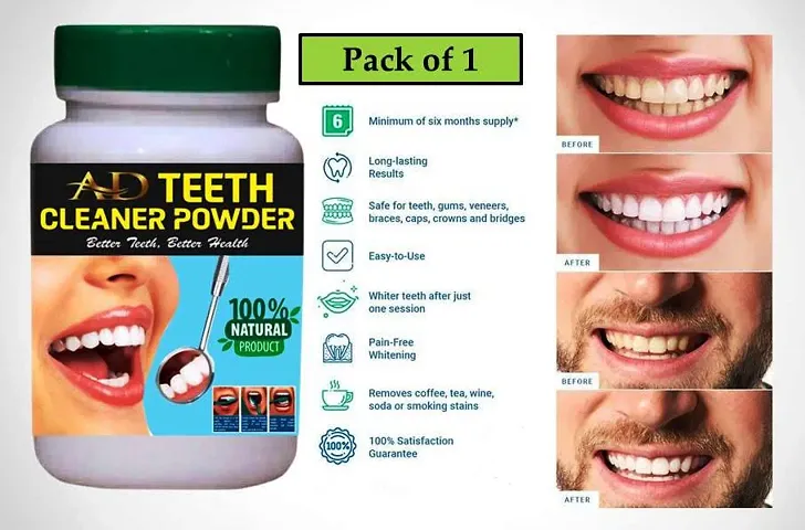 Activated Teeth Whitening Powder (Pack Of 1)