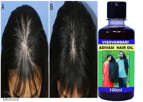 Adivasi Herbal Premium quality hair oil for hair Regrowth (100 ml) Hair Oil  (100 ml)-thumb0