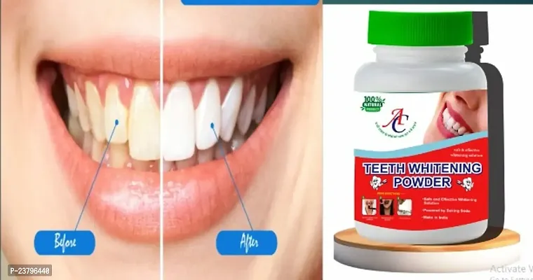 Teeth Whitening Powder 100% Natural Home Made No Chemical