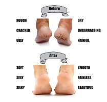 Silicon Gel Heel Pad Socks For Dry, Hard And Cracked Heels Repair-thumb3