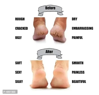 Silicon Gel Heel Pad Socks For Dry, Hard And Cracked Heels Repair-thumb4