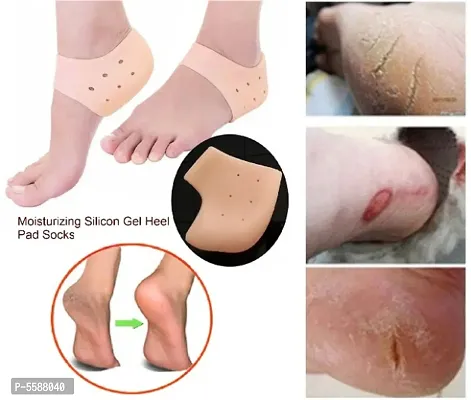 Combo Of Silicon Gel Heel Socks and Silicon Heel Protector-thumb3