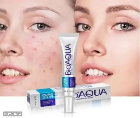 bioaqua acne pimplle remover creamin top quality-thumb0