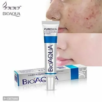 bioaqua acne pimplle remover creamin top quality-thumb0