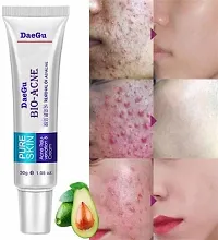 DaeGu Popular Acne/ Pimple Removal Cream for Men and Women-thumb1