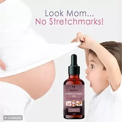 Stretch Marks Oil To Minimize Stretch Marks And Even Out Skin Tone- 40 ml-thumb3