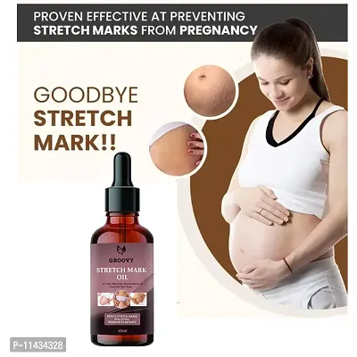 Stretch Marks Oil  Stretch Mark Removal Oil Women And Men, Marks And Spots Removal- 40 ml-thumb4