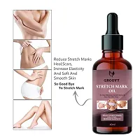 Stretch Marks Oil To Reduce Stretch Marks Of Body, Belly, Thighs, Nourishment For Woman  40  ml-thumb2