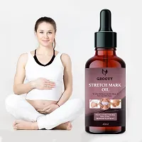 Present Stretch Marks Removal Oil - Natural Heal Pregnancy, , Legs, Mark Oil - 40 ml-thumb1