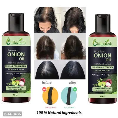 Onion  Help For Rapid Hair Growth,Anti Hair Fall,Split Hair And Promotes Softer  shinier Hair 50ML PACK OF 2-thumb0