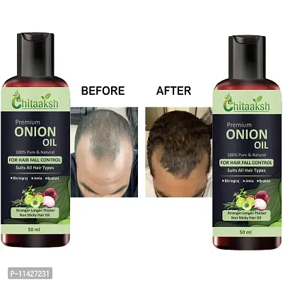 Onion Natural Hair Oil 50 Ml Pack Of 2-thumb0