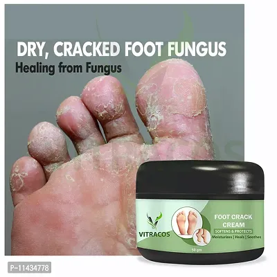 Foot Care Cream For Rough, Feet Cream For Heel Repair Healing And Softening Cream - 50 Grams-thumb0