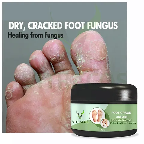 Foot Care Cream For Rough, Feet Cream For Heel Repair Healing And Softening Cream - 50 Grams