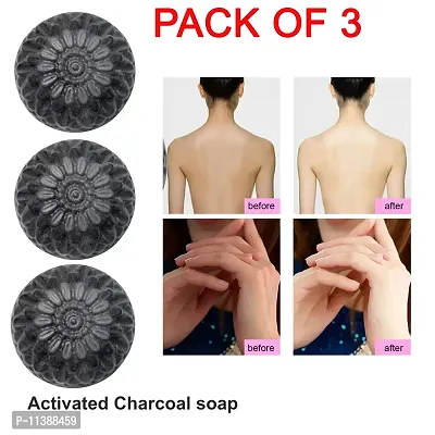 Charcoal Soap100Gm-100 Grams Each, Pack Of 3-thumb0