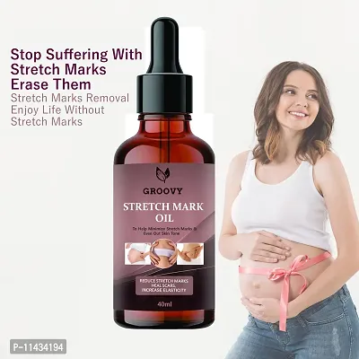 Stretch Marks Oil To Minimize Stretch Marks And Even Out Skin Tone- 40 ml-thumb0