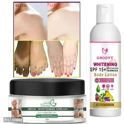 Body Lotion Spf15+ Skin Lighten And Brightening Cream Whitening Cream Shields Your Skin From Hurtful Uv Beams With Whitening Cream Pack Of 2