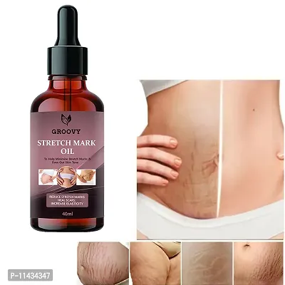 Stretch Marks Oil Anti-Stretch Marks Skin Oil With Vitamin E And Rosehip Oil- 100 ml- 40 ml-thumb0