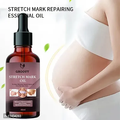 Stretch Marks Oil  Bye Bye Stretch Marks Oil- 40 ml-thumb0