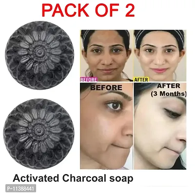 Deep Cleaning And Exfoliating Activated Charcoal Soap For Men And Women- 100 Grams Each, Pack Of 2-thumb0