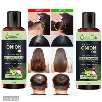 Onion Oil For Hair Regrowth And Hair Fall Control Hair Oil - 50 Ml Pack Of 2-thumb0