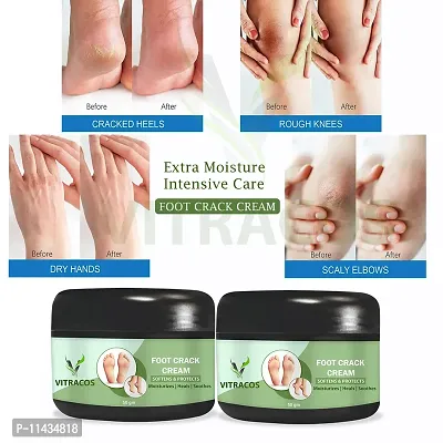 Organic Foot Cream With Green Tea For Skin Hydration- Pack Of 2, 50 Grams each-thumb0