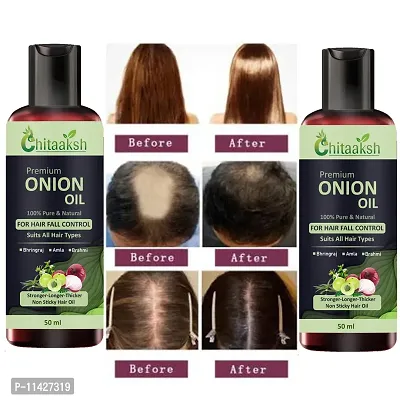 Onion Oil For Hair Regrowth And Hair Fall Control Hair Oil -Pack Of Pack Of 2-thumb0