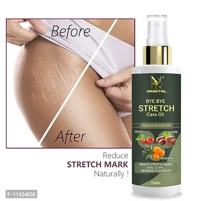 Nainital  Stretch Mark Removal Oil For Men And Women - 100 ml-thumb0