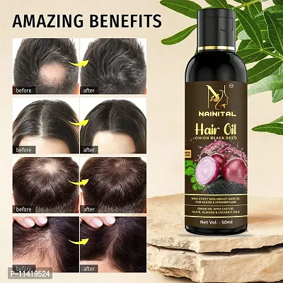 Onion Black Seed Hair Oil 50 Ml Buy 3 Get 3 Free-thumb4