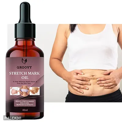 Stretch Marks Oil  Bye Bye Stretch Marks Oil- 40 ml-thumb0