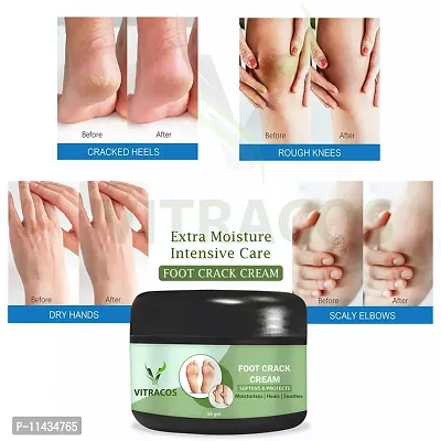 Foot Care Cream  Feet Cream For Heel Repair Healing And Softening Cream- Grams-thumb0