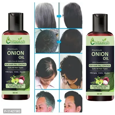 Red Onion Black Seed Hair Oil-50 Ml Pack Of 2-thumb0