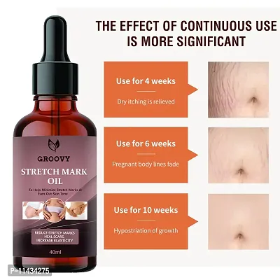 Stretch Marks Oil  Stretch Mark Removal Oil Women And Men, Marks And Spots Removal- 40 ml-thumb0