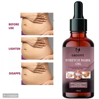 Stretch Marks Scar Removal Cream Oil In During After Remover Scars- 40 ml-thumb0