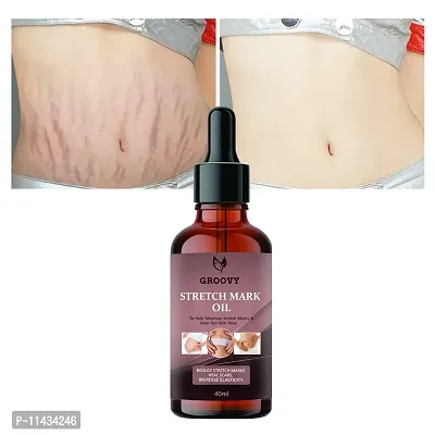 Stretch Marks Oil Present Repair Stretch Marks Removal - Natural Heal Pregnancy Breast, Hip, Legs, Mark Oil 40  ml-thumb0