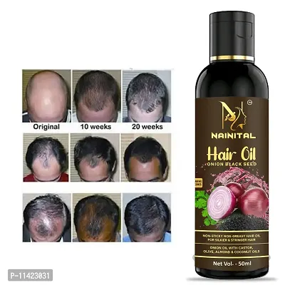 Hair Oil Challenge For Hair Growth For Men And Women Pack 1-thumb0