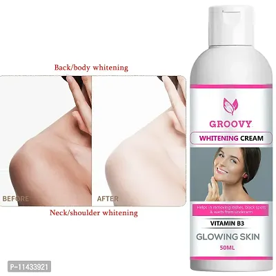 Skin Whitening Lotion Cream Look As Young As U Feel -Acne Care Face Cream, Face Cream - 50 Ml-thumb0