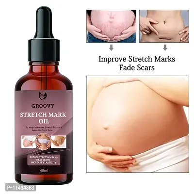 Stretch Marks Oil  After Delivery Stretch Mark Removal Oil 40 ml-thumb0