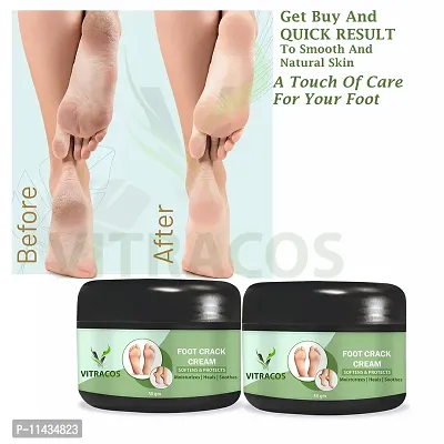 Foot Cream For Rough, Dry And Cracked Heel, With Benefits Of Eucalyptus Oil- Pack Of 2, 50 Grams each