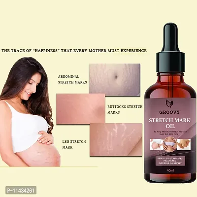 Stretch Marks Oil  After Delivery Stretch Mark Removal Oil 40 ml-thumb0