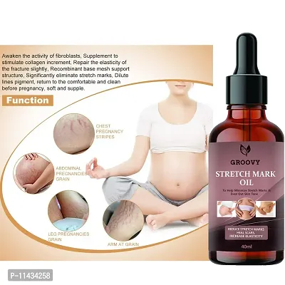 Stretch Marks Oil  After Delivery Stretch Mark Removal Oil 40 ml-thumb0