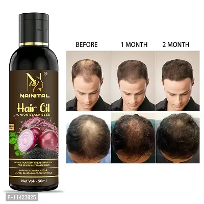 Hair Oil Black Seed Hair Oil 50 Ml-thumb0