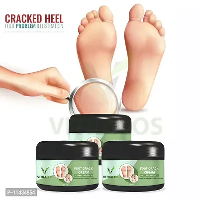 Foot Bath Soothing Cracked Heels Repair Cream With  Aromatherapy Spa Pedicure Gelatinous Mixture- Pack Of 3, 50 Grams each-thumb0