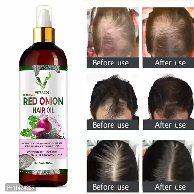 Organique Red Onion Hair Oil With Keratin Protein Booster, Nourishes Hair Follicles, Anti - Hair Loss, Regrowth Hair Oil -200 Ml-thumb0